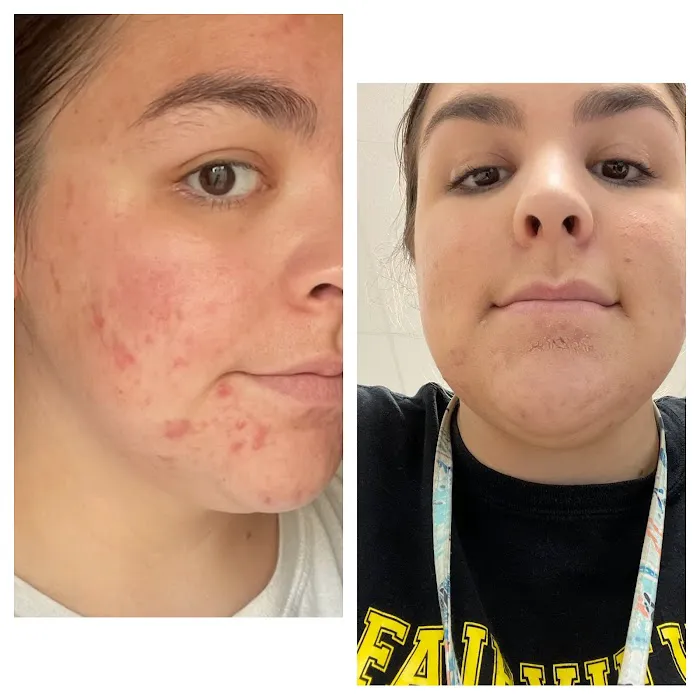 The Acne Clinic co Picture 8