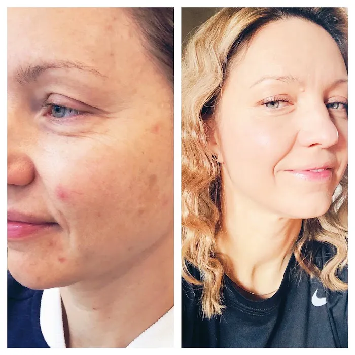 The Acne Clinic co Picture 10