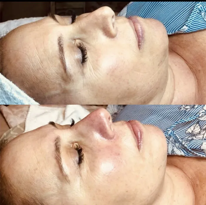 Tru U Esthetix Picture 3