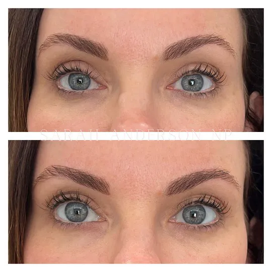 Anderson Aesthetics Picture 5