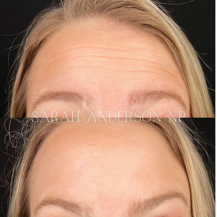 Anderson Aesthetics Picture 9