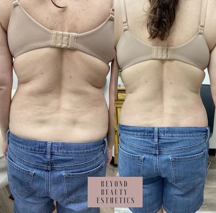 Beyond Beauty Esthetics Picture 2