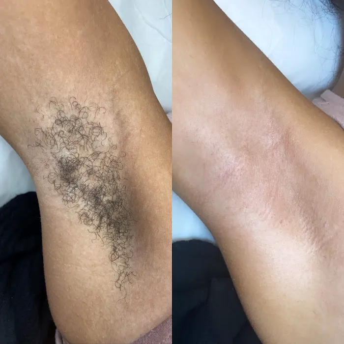 Beyond Beauty Esthetics Picture 6