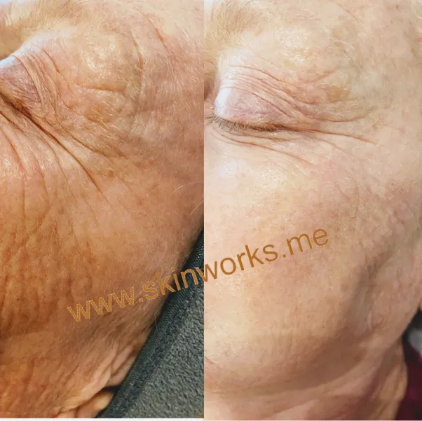 SkinWorks Picture 10