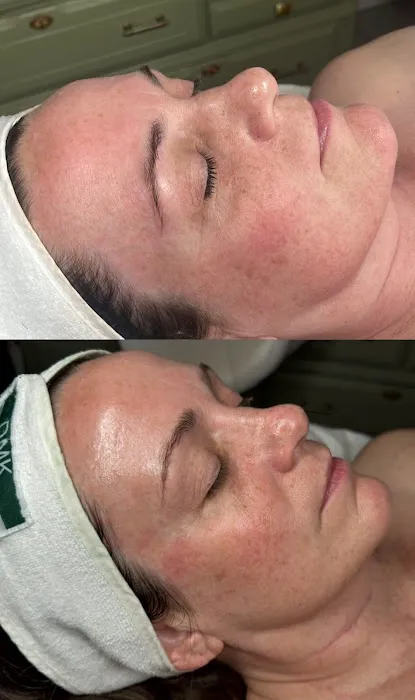 Skin By Erin Picture 1