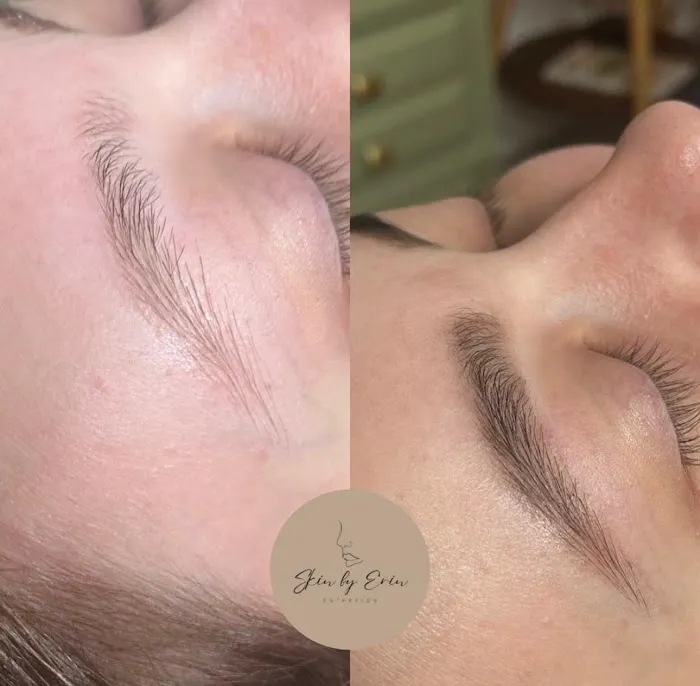 Skin By Erin Picture 3