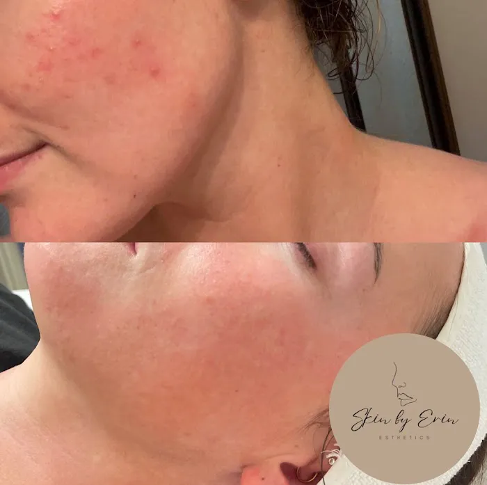 Skin By Erin Picture 5