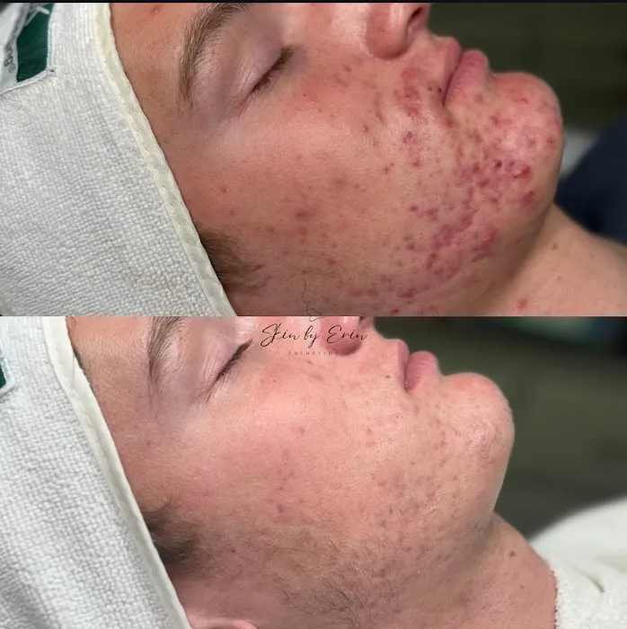 Skin By Erin Picture 6