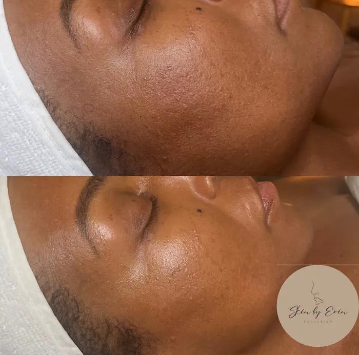 Skin By Erin Picture 8