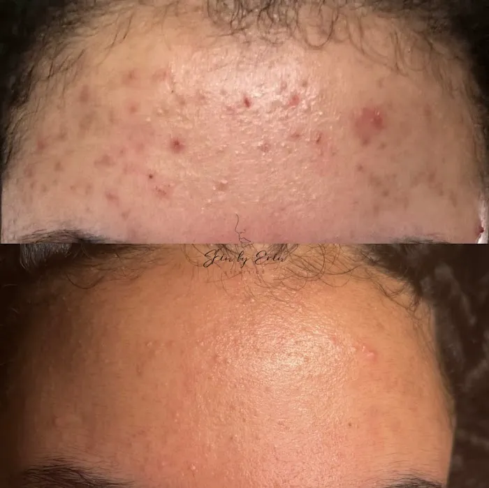 Skin By Erin Picture 10