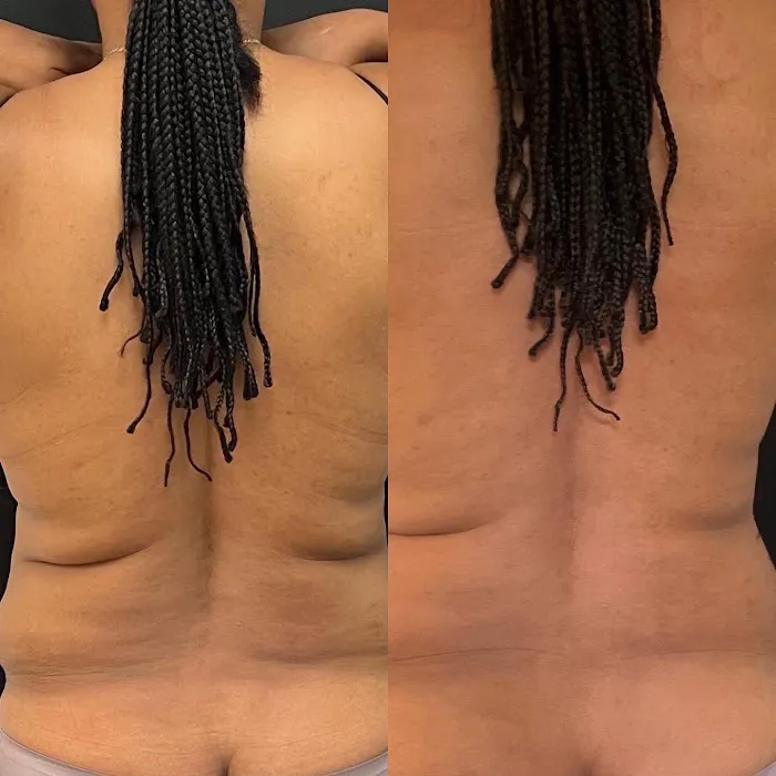 SunGlo Aesthetics Picture 3