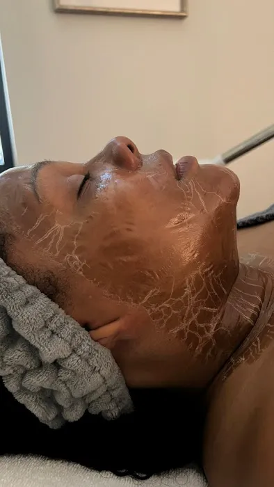 SunGlo Aesthetics Picture 5