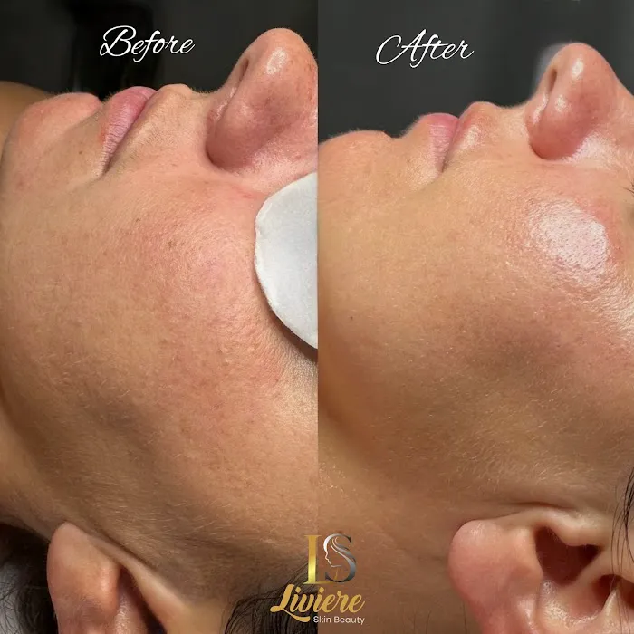 Liviere Skin Beauty Picture 8