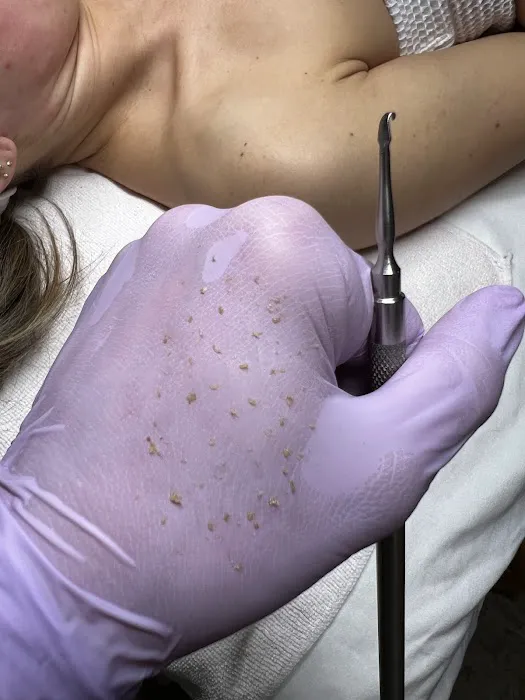 Sunshine Esthetics LLC Picture 10