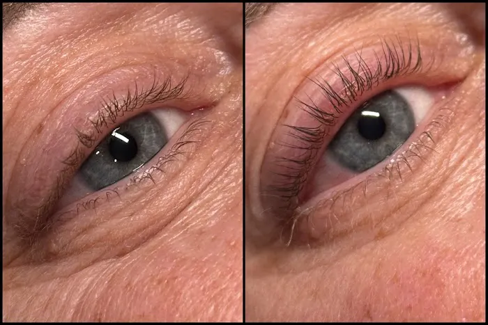 Kim Miller Skin Picture 4