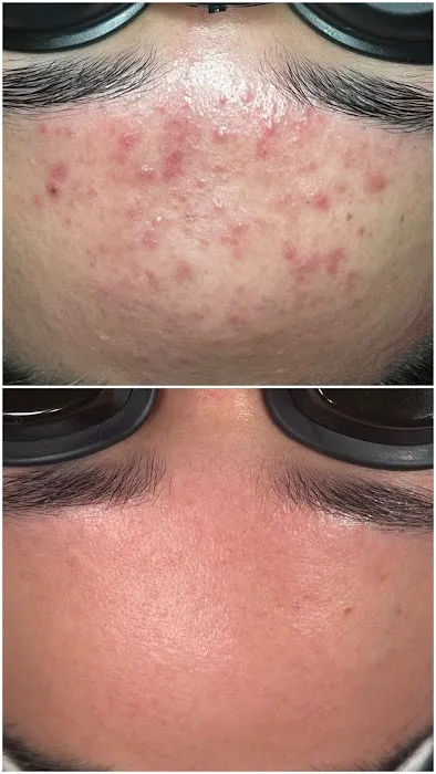 Kim Miller Skin Picture 1