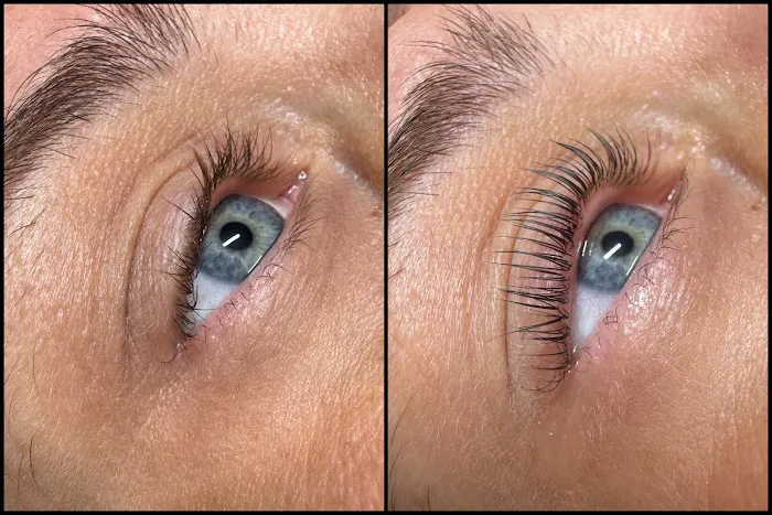 Kim Miller Skin Picture 5