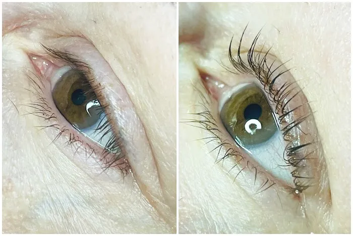 Kim Miller Skin Picture 8