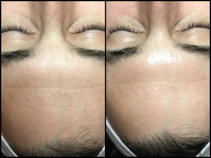 Kim Miller Skin Picture 10