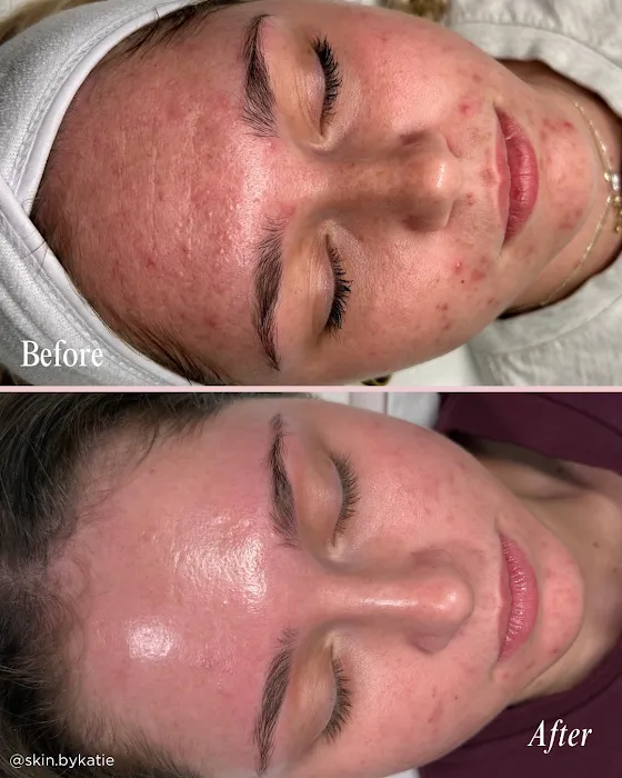 Skin By Katie, PLLC Picture 9