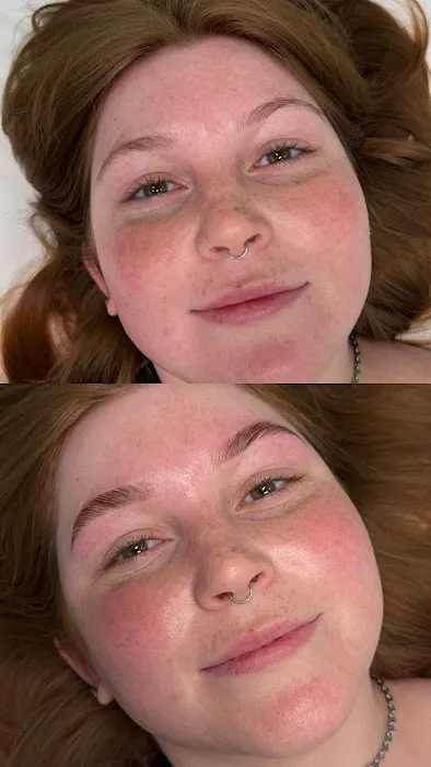 Skin By Katie, PLLC Picture 7