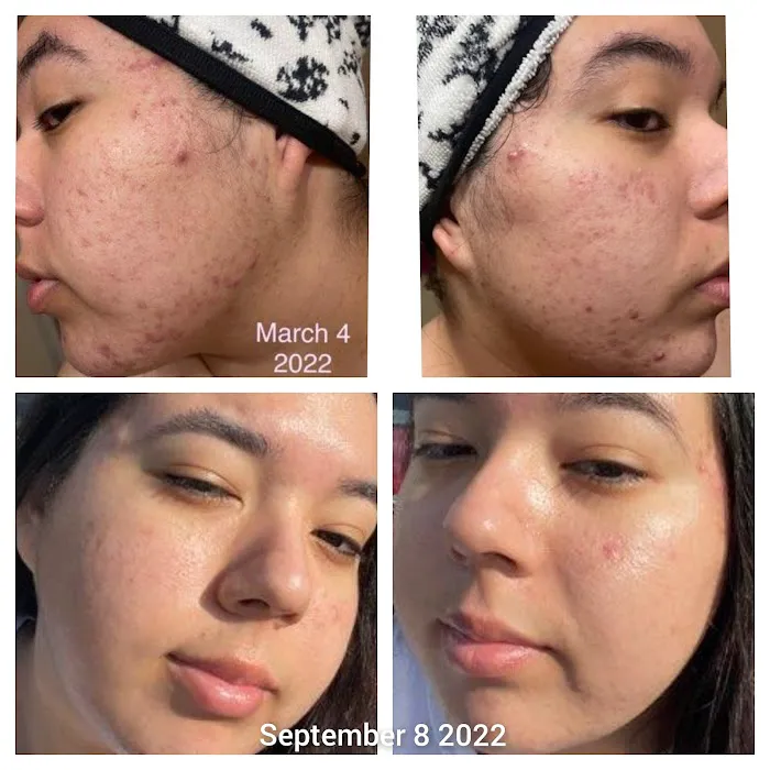 Elevated Skin Spa Picture 7