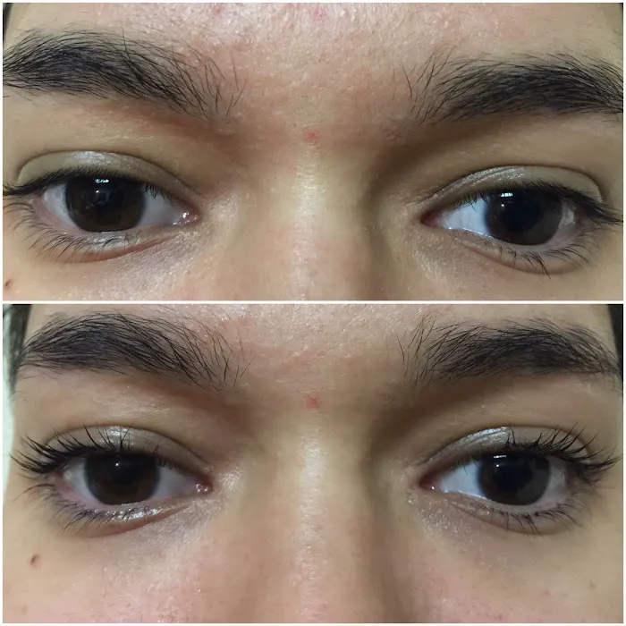 Skin Voodoo Picture 6