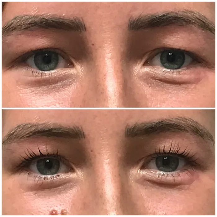 Skin Voodoo Picture 5