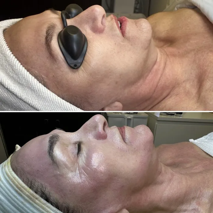 April Marie Glow Skincare Picture 8