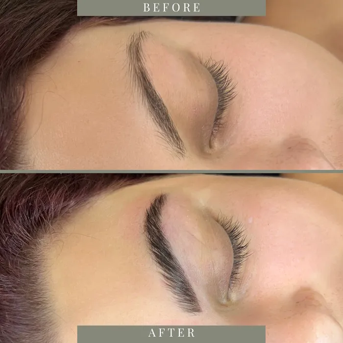 Bare Beauty Aesthetics | Chandler Acne Specialist + Brow Design Picture 6