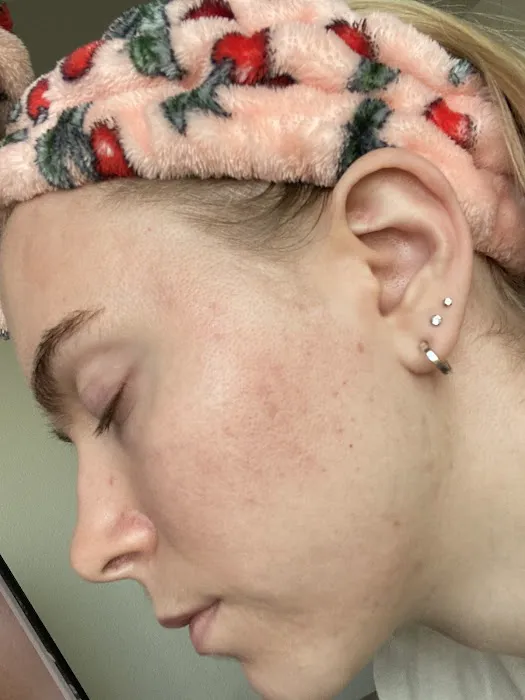 AZ SKIN REHAB Picture 10