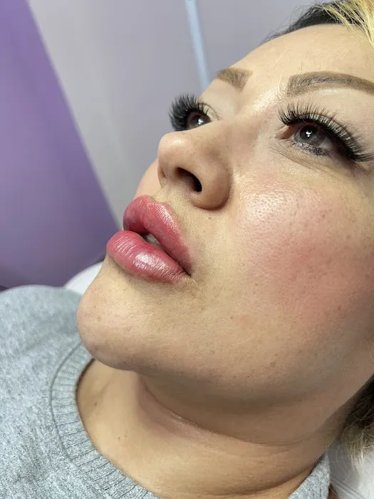 Medi Estetic Picture 1