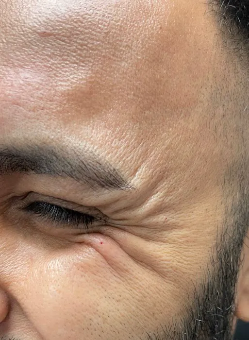 Medi Estetic Picture 4