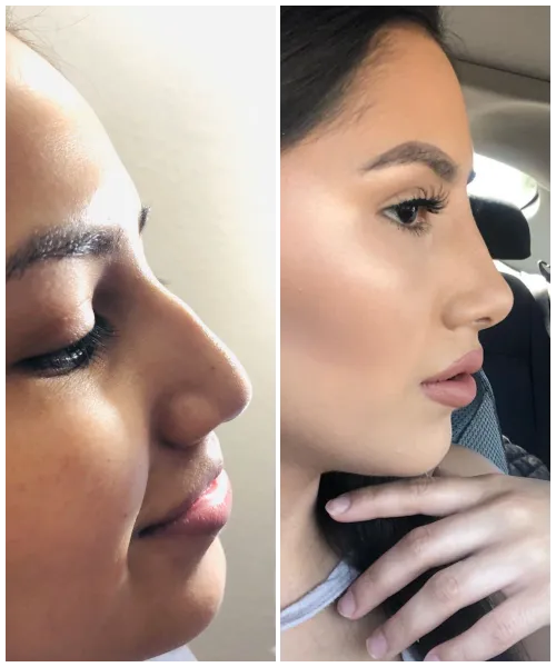 Medi Estetic Picture 6