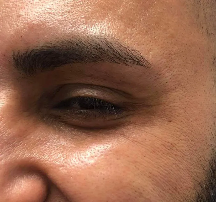 Medi Estetic Picture 7