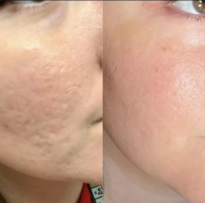 Medi Estetic Picture 9