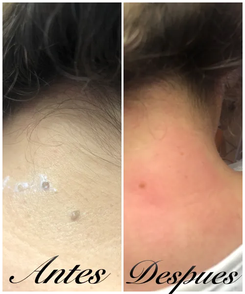 Medi Estetic Picture 8