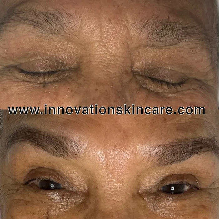 Innovation skin care Picture 7