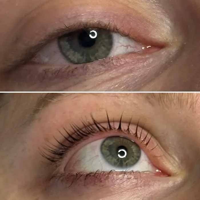 Innovation skin care Picture 10