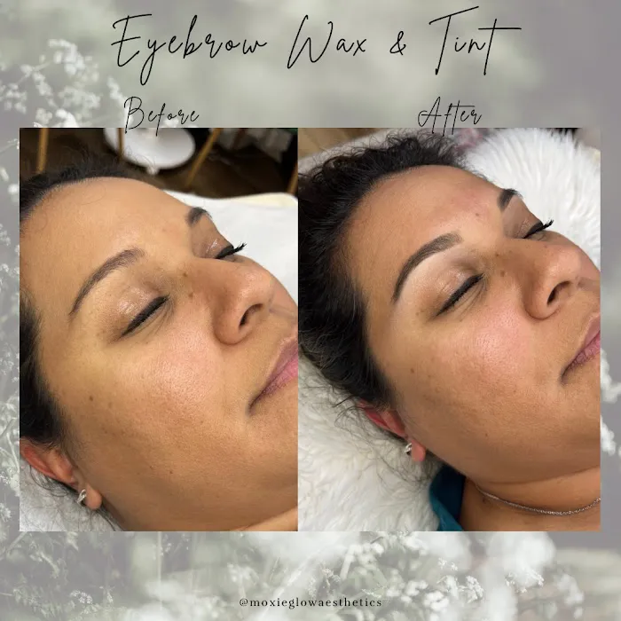 Moxie Glow Picture 5