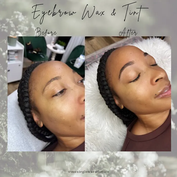 Moxie Glow Picture 9