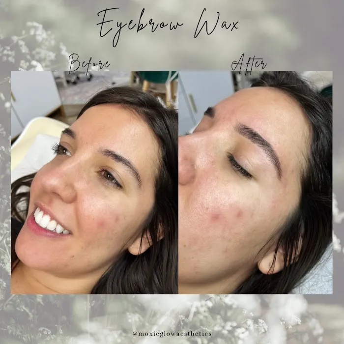 Moxie Glow Picture 8