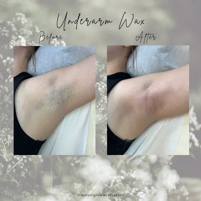 Moxie Glow Picture 10