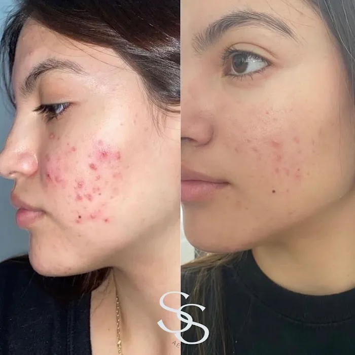 Sydnee Short Aesthetics Picture 6