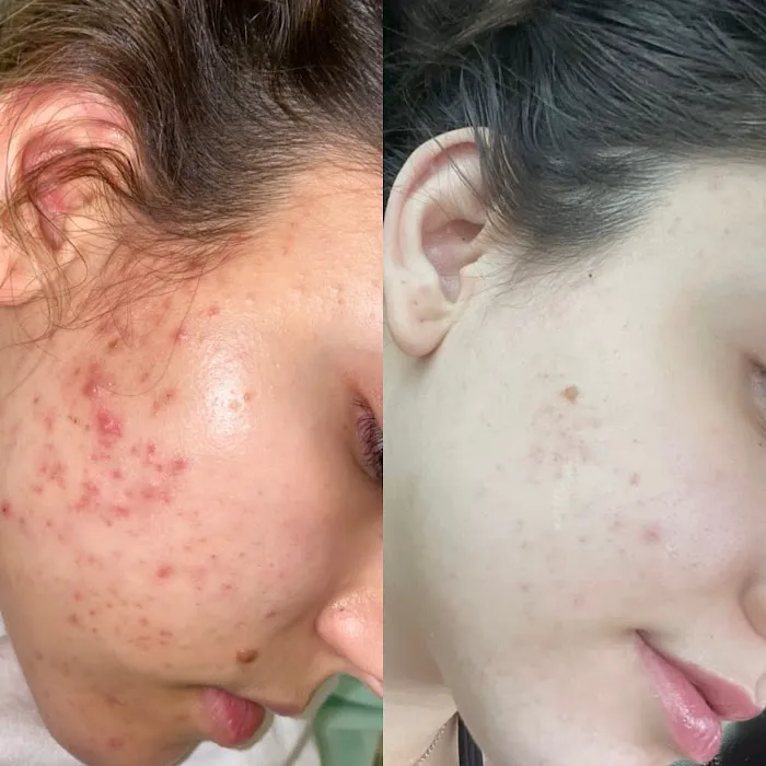 Sydnee Short Aesthetics Picture 10