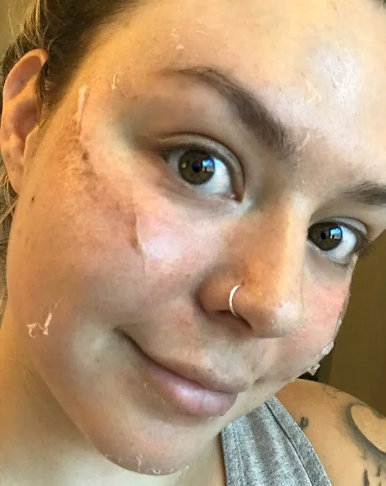 The Refined Rebel skin, beauty and tattoo Picture 6