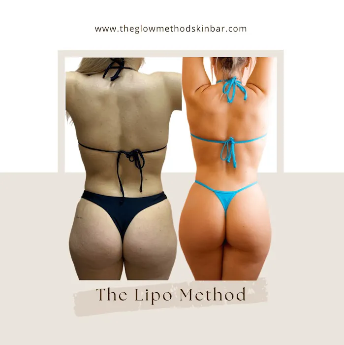 The Glow Method Skin Bar Picture 7