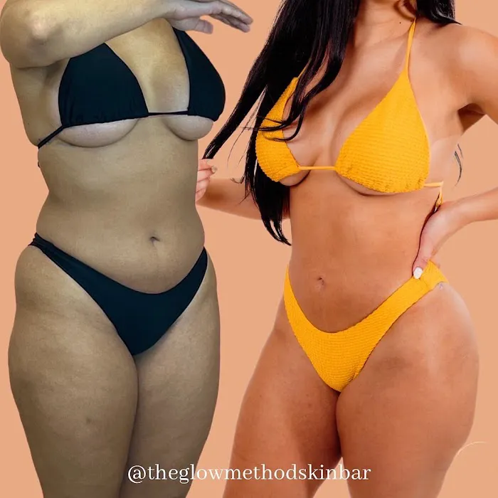 The Glow Method Skin Bar Picture 5