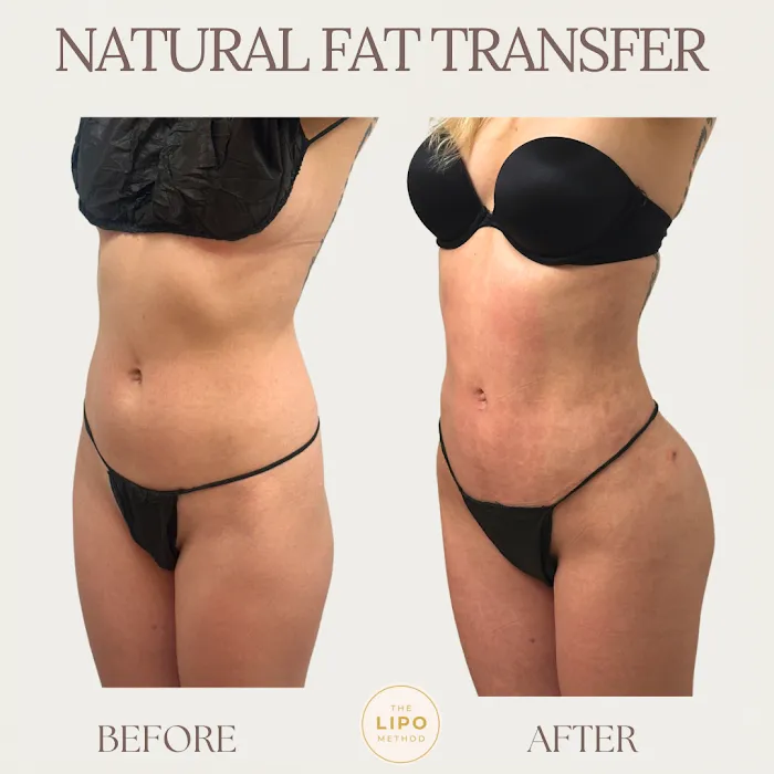 The Glow Method Skin Bar Picture 10