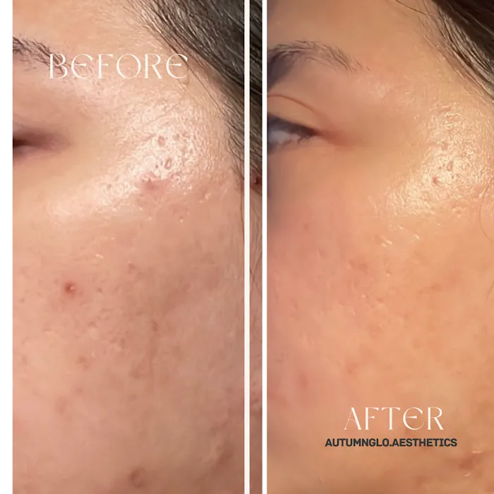 AutumnGlo Aesthetics Picture 3